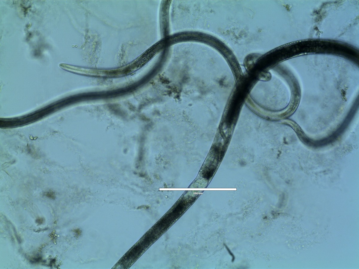 Представитель Семейства Panagrolaimidae